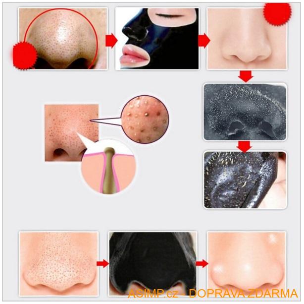 Pleťová maska (5 ks)