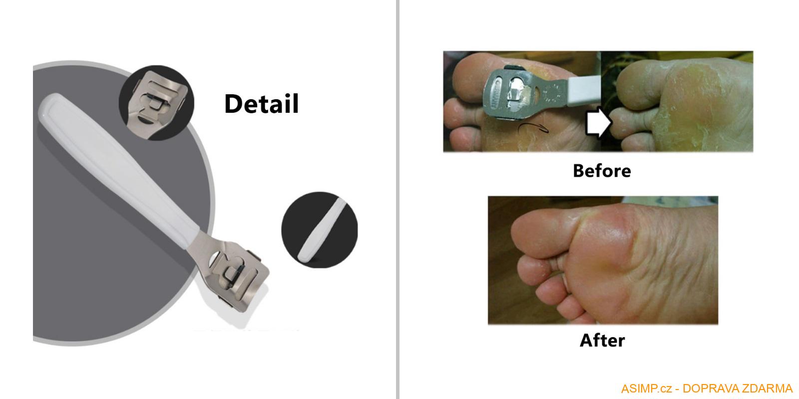 Škrabka na ztvrdlou kůži / A-000336