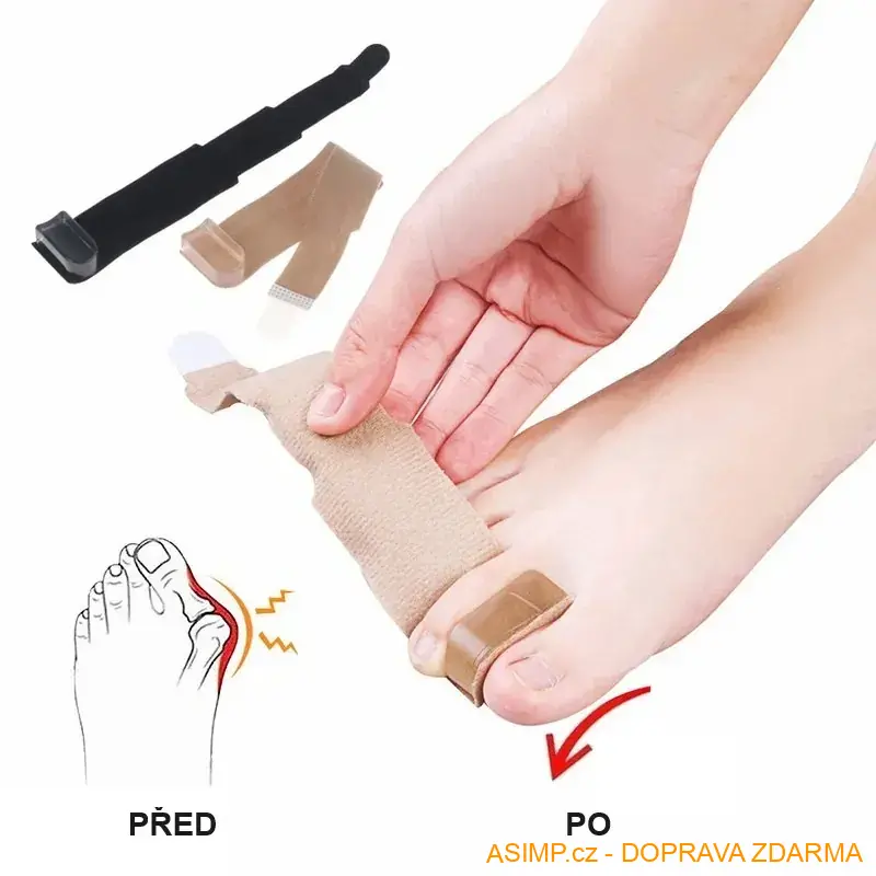 Korektor - separátor vbočeného palce (1 ks - tělová) / A-003277 / DOPRAVA ZDARMA