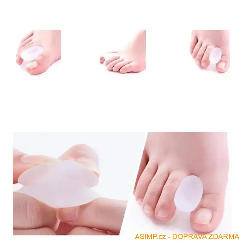 Korektor oddělovač vbočeného palce (2 ks) / A-000136 / DOPRAVA ZDARMA