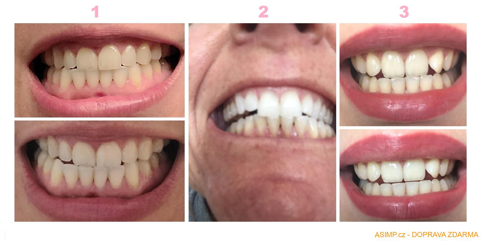 Pero na bělení zubů (5 ml) / A-001709 / DOPRAVA ZDARMA