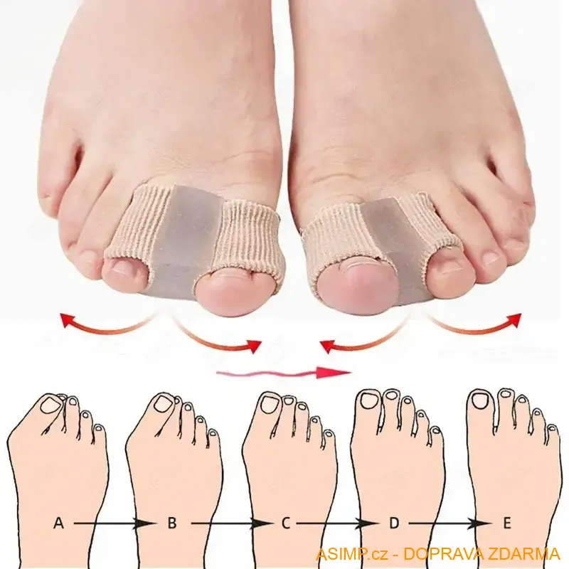 Korektor - separátor vbočeného palce (2 ks - S) / A-003276 / DOPRAVA ZDARMA