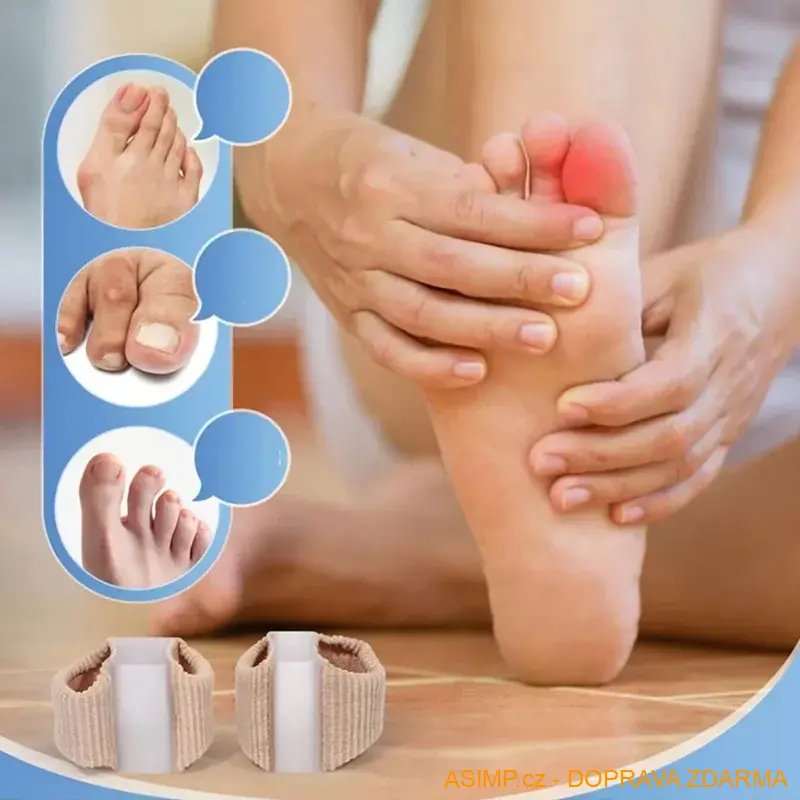 Korektor - separátor vbočeného palce (2 ks - S) / A-003276 / DOPRAVA ZDARMA